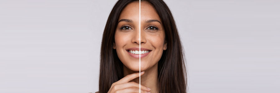 Anti-Aging Treatments